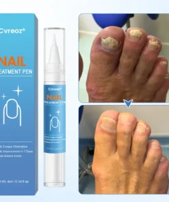 Cvreoz® MycoErase Nail Revive Pen