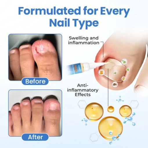 Cvreoz® MycoErase Nail Revive Pen