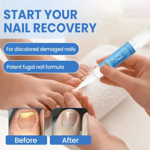 Cvreoz® MycoErase Nail Revive Pen