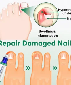 Cvreoz® Nail Care Roll-On