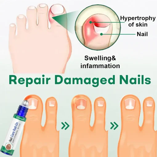Cvreoz® Nail Care Roll-On