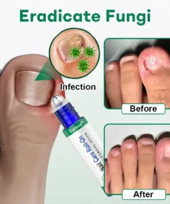 Cvreoz® Nail Care Roll-On