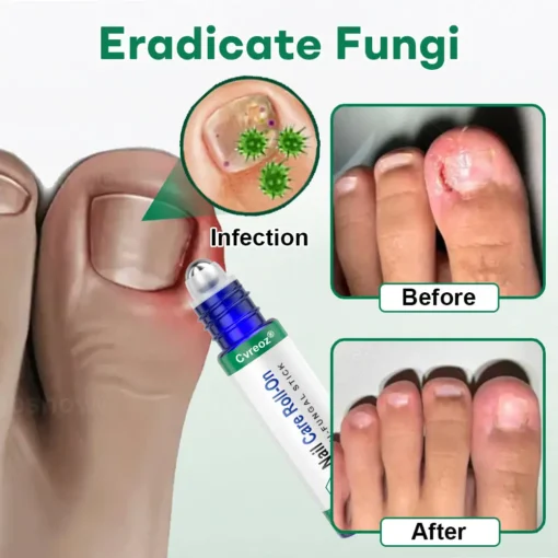 Cvreoz® Nail Care Roll-On