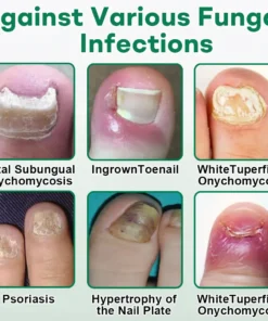 Cvreoz® Nail Care Roll-On