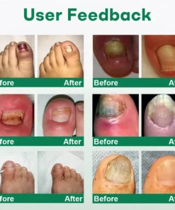Cvreoz® Nail Care Roll-On