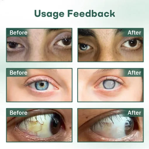 Cvreoz® Nano Eye Drops Serum Pro