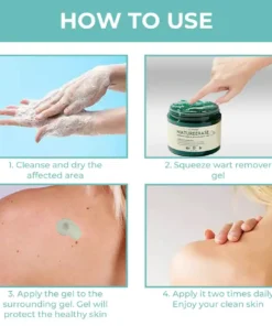 Cvreoz® NatureErase Instant Mole & Spot Removal Gel