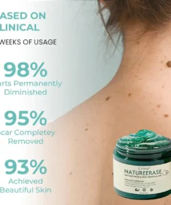 Cvreoz® NatureErase Instant Mole & Spot Removal Gel