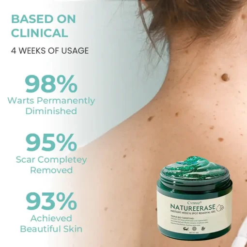 Cvreoz® NatureErase Instant Mole & Spot Removal Gel