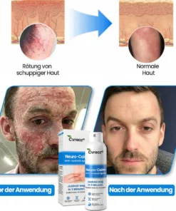 Cvreoz® Neuro-Calm Anti-Juckreiz Akut-Spray