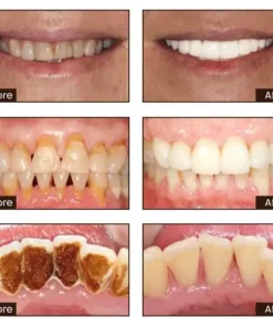 Cvreoz® Niacinamide Intensive Whitening Toothpaste