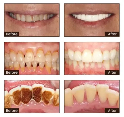 Cvreoz® Niacinamide Intensive Whitening Toothpaste