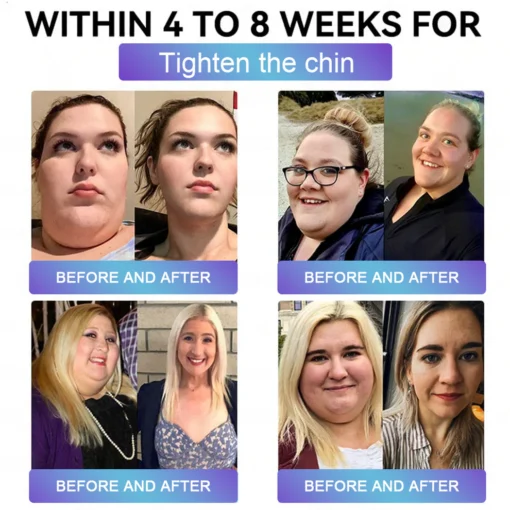 Cvreoz® EGCG + GLP-1 Dual-Action Slimming & Skin-Nourishing Oral Solution - Image 4