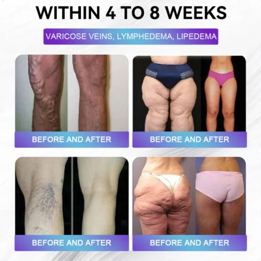 Cvreoz® EGCG + GLP-1 Dual-Action Slimming & Skin-Nourishing Oral Solution - Image 3