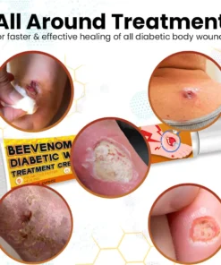 Cvreoz® Bee Venom Diabetic Wounds Treatment Cream