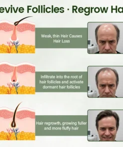 Cvreoz® Follicure BioGrow Hair Restoration Spray