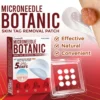 Cvreoz® MicroNeedle Botanic Skin Tag Removal Patch