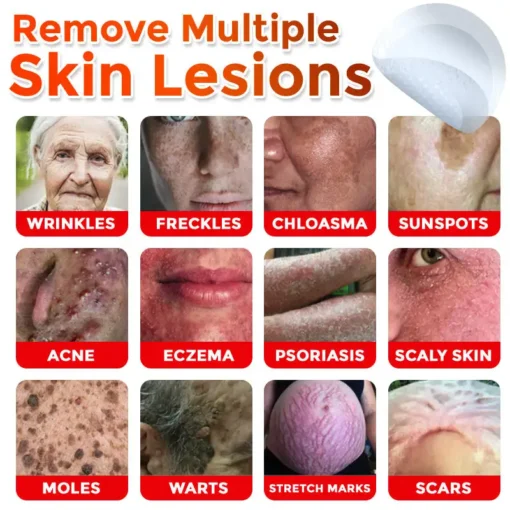 Cvreoz® MicroNeedle Botanic Skin Tag Removal Patch