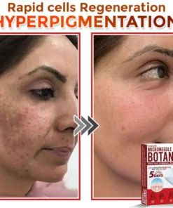 Cvreoz® MicroNeedle Botanic Skin Tag Removal Patch