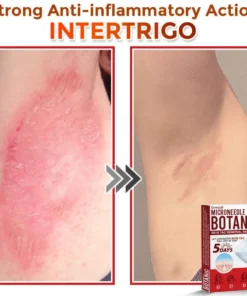 Cvreoz® MicroNeedle Botanic Skin Tag Removal Patch