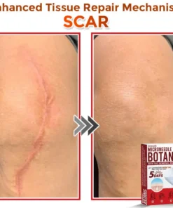 Cvreoz® MicroNeedle Botanic Skin Tag Removal Patch