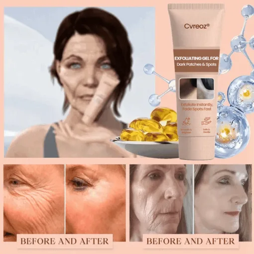 Cvreoz® Purifying Exfoliating Gel