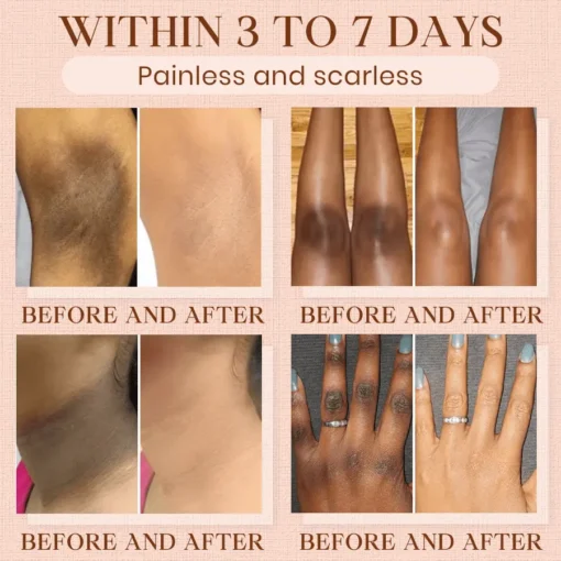 Cvreoz® Purifying Exfoliating Gel