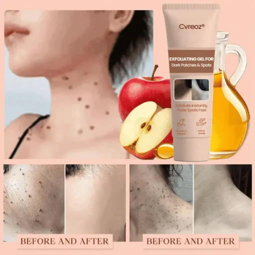 Cvreoz® Purifying Exfoliating Gel
