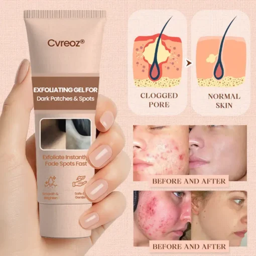 Cvreoz® Purifying Exfoliating Gel