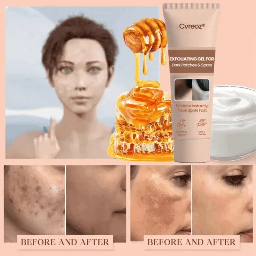 Cvreoz® Purifying Exfoliating Gel