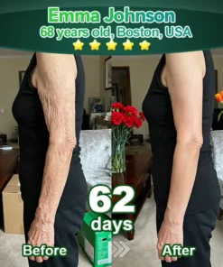 Cvreoz® 𝑆𝑡𝑒𝑚 𝐶𝑒𝑙𝑙 & 𝐶𝑜𝑙𝑙𝑎𝑔𝑒𝑛 𝑃𝑒𝑝𝑡𝑖𝑑𝑒 𝑂𝑟𝑎𝑙 𝐷𝑟𝑜𝑝𝑠