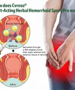 Cvreoz® Fast-Acting Herbal Hemorrhoid Spray Pro