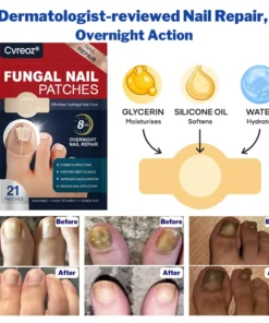 Cvreoz® - Fungal Nail Patches