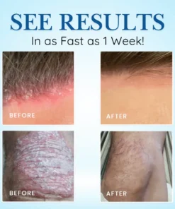 Cvreoz® Source-Relief Magnesium Spray