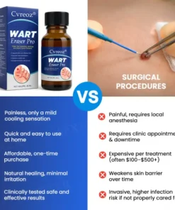 Cvreoz® Wart Eraser Pro