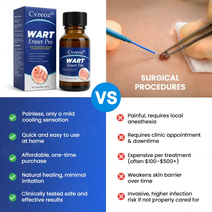 Cvreoz® Wart Eraser Pro