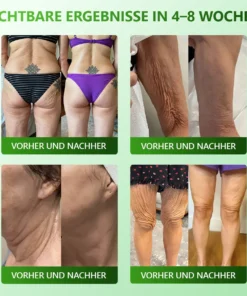 Cvreoz® 𝗬𝗼𝘂𝐭𝐡𝐆𝗹𝗼𝘄 𝑺𝒕𝙖𝙢𝙢𝙯𝙚𝒍𝒍𝒆𝒏 𝙆𝙤𝒍𝒍𝒂𝙜𝙚𝒏 𝗧𝗿𝗼𝒑𝐟𝙚𝙣