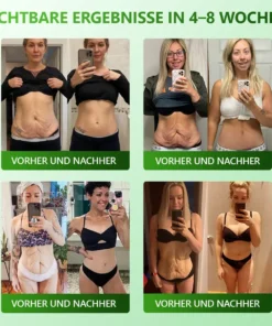 Cvreoz® 𝗬𝗼𝘂𝐭𝐡𝐆𝗹𝗼𝘄 𝑺𝒕𝙖𝙢𝙢𝙯𝙚𝒍𝒍𝒆𝒏 𝙆𝙤𝒍𝒍𝒂𝙜𝙚𝒏 𝗧𝗿𝗼𝒑𝐟𝙚𝙣