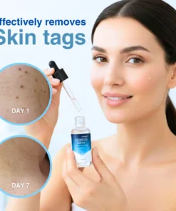 Cvreoz® Advanced Skin Tag & Wart Removal Essence