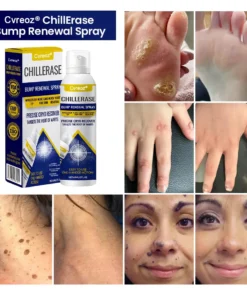 Cvreoz® ChillErase Bump Renewal Spray