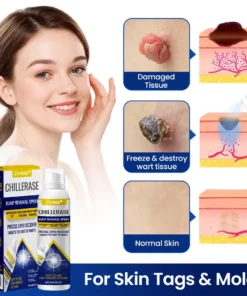 Cvreoz® ChillErase Bump Renewal Spray