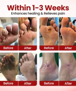 Cvreoz® DermaLuxe Diabetic Relief Cream