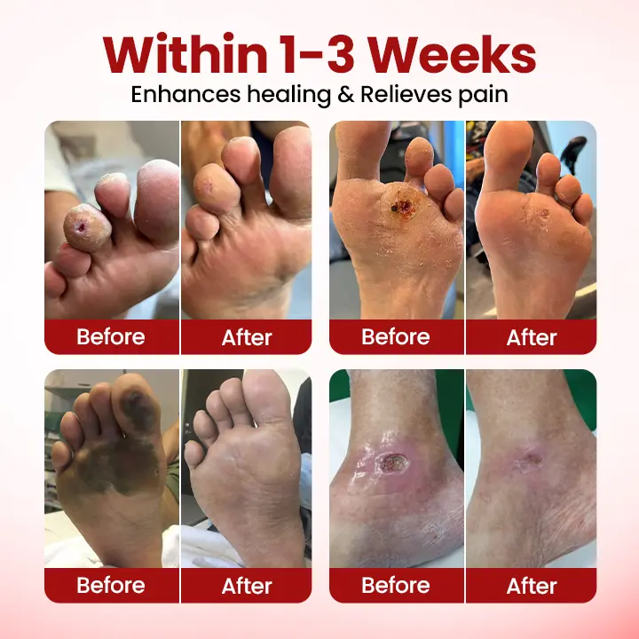 Cvreoz® DermaLuxe Diabetic Relief Cream