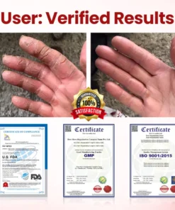 Cvreoz® DermaLuxe Diabetic Relief Cream