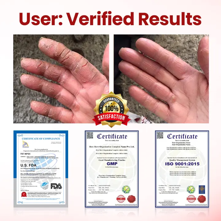 Cvreoz® DermaLuxe Diabetic Relief Cream