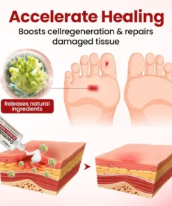 Cvreoz® DermaLuxe Diabetic Relief Cream