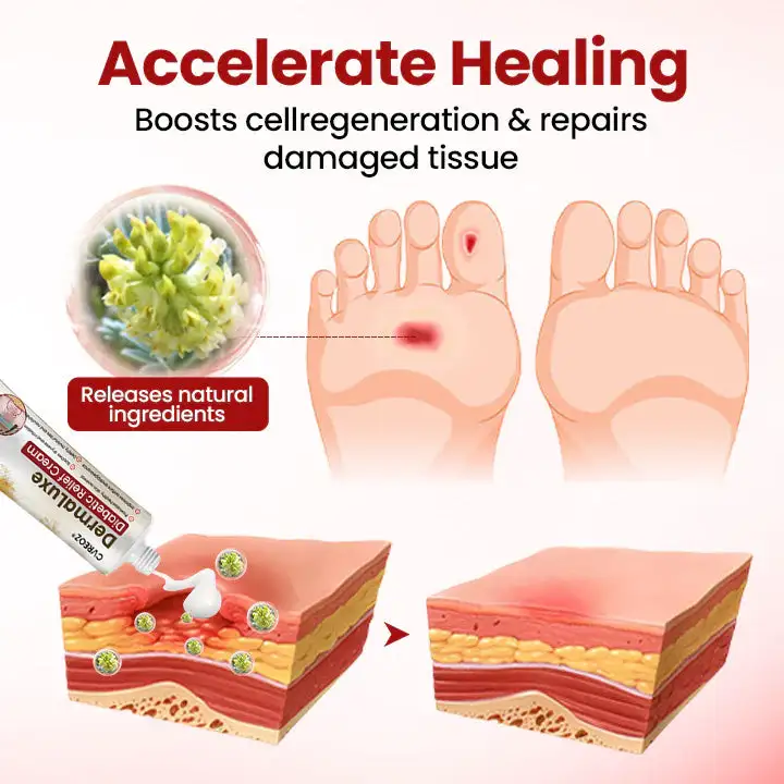 Cvreoz® DermaLuxe Diabetic Relief Cream