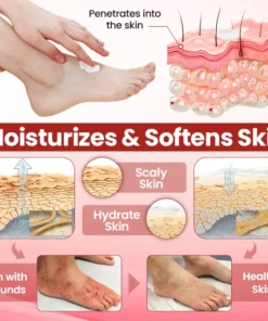 Cvreoz® DermaLuxe Diabetic Relief Cream