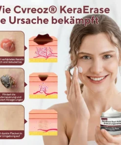 Cvreoz® KeraErase Dual-Action Erneuerungscreme