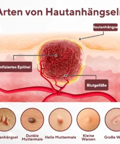 Cvreoz® KeraErase Dual-Action Erneuerungscreme